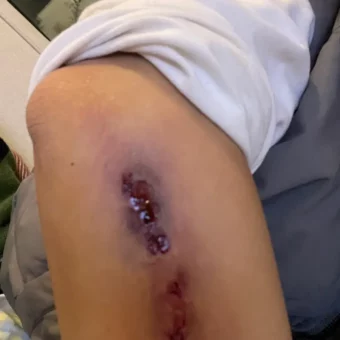 照片 | “100%应付请假的照片”