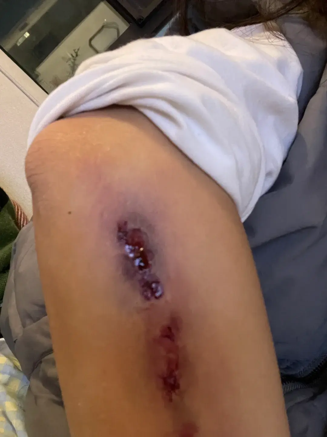 照片 | “100%应付请假的照片”